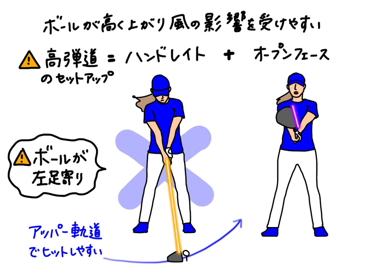 画像: イラストA:ハンドレイト、オープンフェースはボールが高く打ち上がるセットアップ。アッパー軌道でヒットしやすくなり、ボールが吹き上がる原因になる