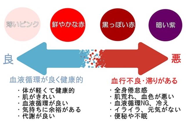 画像1: カッピングの色で身体の状態が分かる!