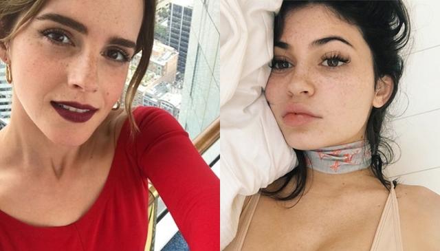 画像: そばかすがキュートなセレブたち。女優のエマ・ワトソンやリアリティスターのカイリー・ジェナーも自撮りの「そばかすショット」を公開。©Emma Watson, Kylie Jenner