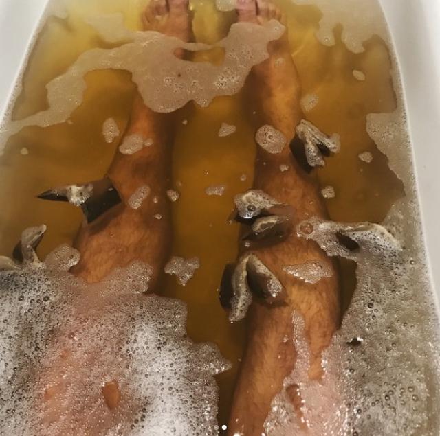 画像2: 「紅茶」で日焼けケア?