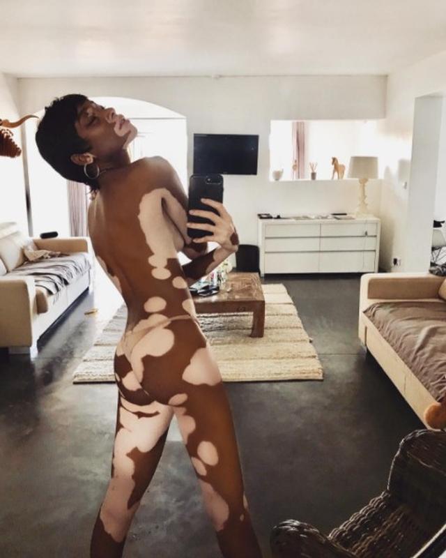 画像2: 世界で最も美しい「まだら肌」を持つモデルがTバッグ1枚の写真を投稿