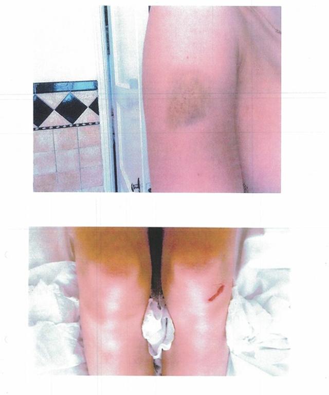 画像: 裁判資料にエルシーが証拠として提出した写真。