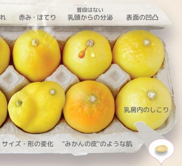 画像4: 乳がんの早期発見を推進