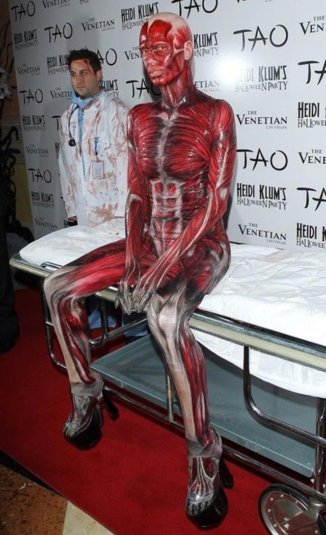 画像2: 2011年:ゴリラ・死体