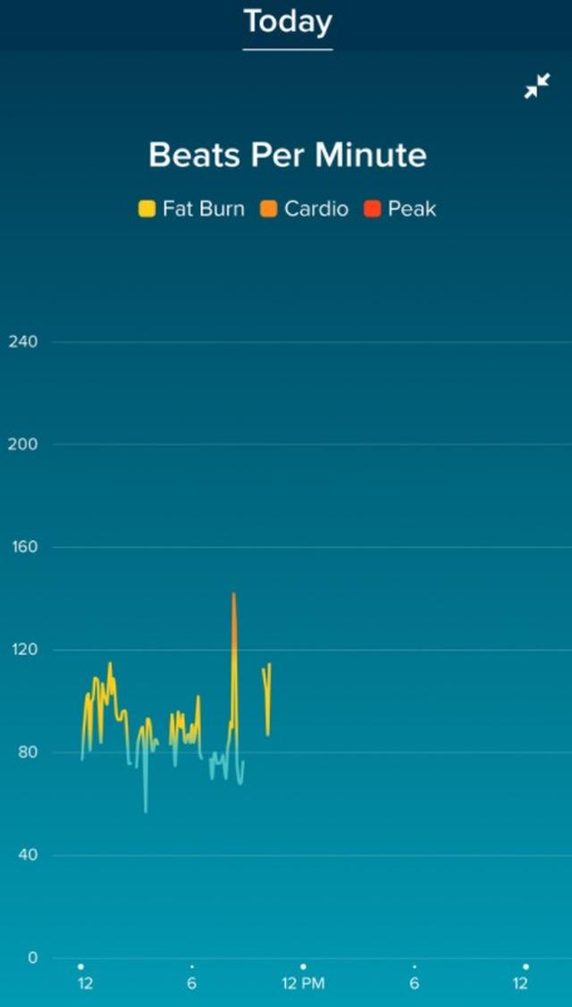 画像: FitBitに残っていた心電図。©twitter/thomas_resch