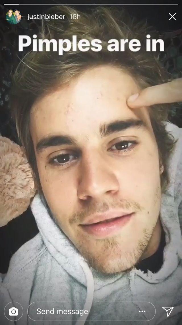 画像: ©instagram/Justin Bieber