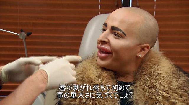 画像2: 『Botched:整形手術の光と闇 シーズン2』第6話