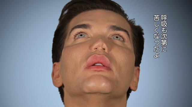 画像2: 『Botched:整形手術の光と闇 シーズン4』第6話