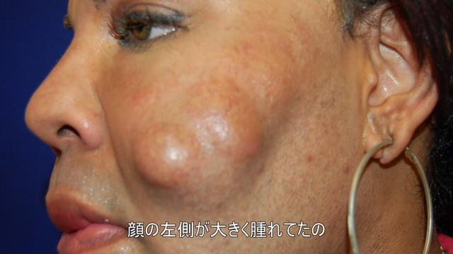 画像2: 『Botched:整形手術の光と闇 シーズン2』第2話より