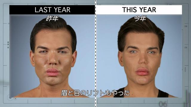 画像1: 『Botched:整形手術の光と闇 シーズン4』第6話