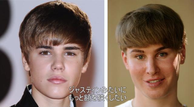 画像: 10代の頃のジャスティン・ビーバーに近づこうとするトビー・シェルドン。手術後の顔を見た恋人女性は驚いていたと、『Botched:整形手術の光と闇』にて明かした。