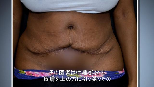 画像2: 『Botched:整形手術の光と闇 シーズン1』第4話