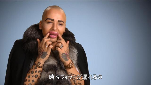 画像1: 『Botched:整形手術の光と闇 シーズン2』第6話