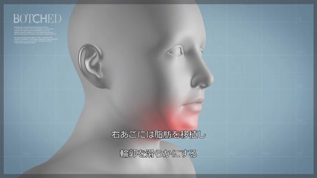 画像4: カリスマ医師が 四角型からハート型 へと輪郭を形成