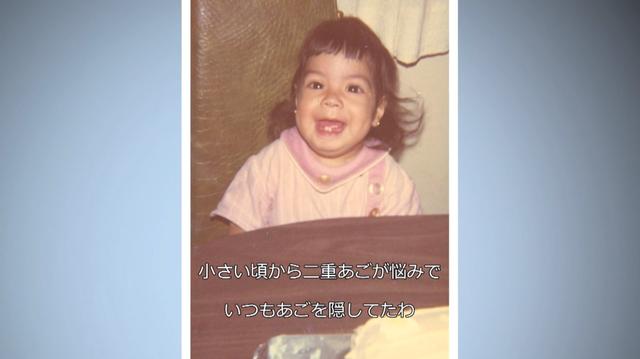 画像1: ネットで見つけた整形外科医による 小顔整形 が大失敗