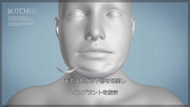 画像2: カリスマ医師が 四角型からハート型 へと輪郭を形成