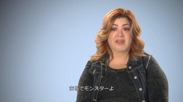 画像2: ネットで見つけた整形外科医による 小顔整形 が大失敗