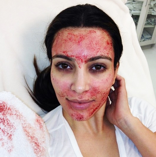 画像2: カーダシアン姉妹が試した美容法