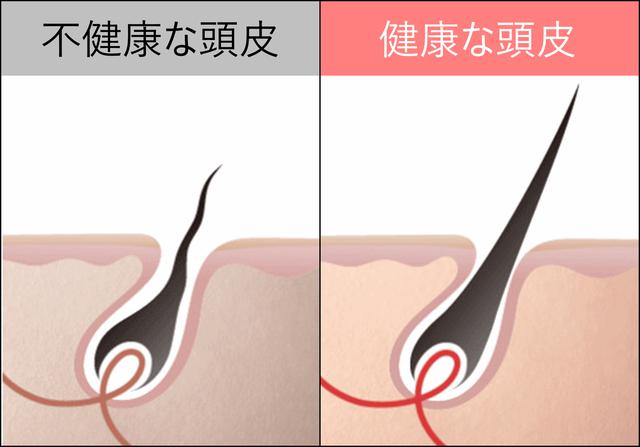 画像1: 「ビタブリッドCヘアー」は 頭皮年齢へのアプローチ で発毛促進