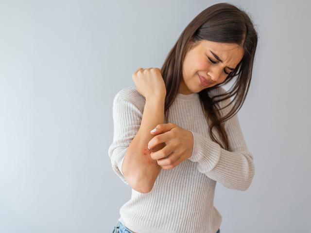 画像: 一般的な「日焼け」と、なにが違うの?