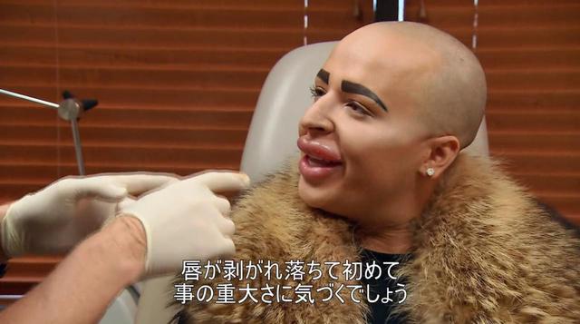 画像: SNSなどで有名な美容整形中毒たちも登場。彼らに医師たちがかける言葉とは?