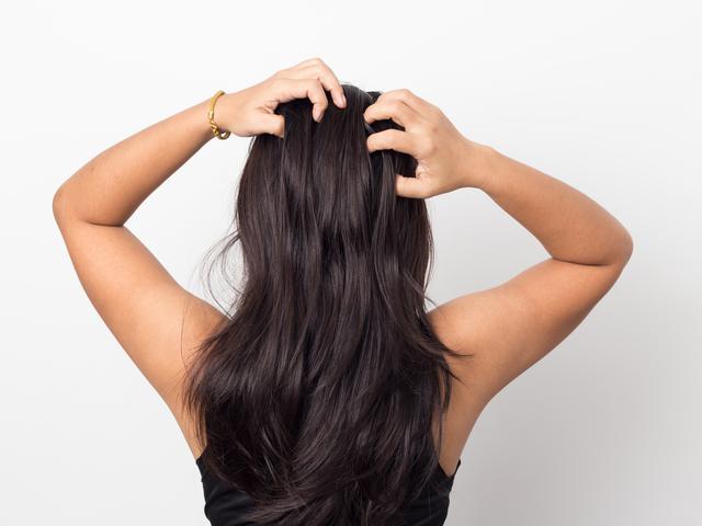 画像1: つけすぎたヘアケア剤や皮脂汚れが原因!?