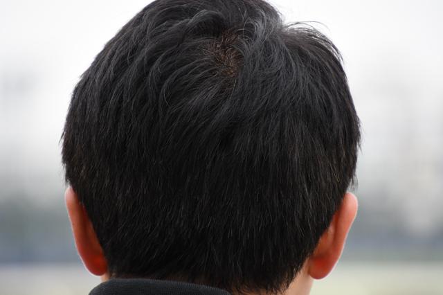 画像1: 400mm