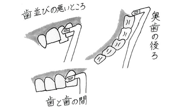 画像: みがきづらい細かい部分に