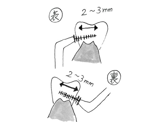 画像: 歯間ブラシは部分的に使う