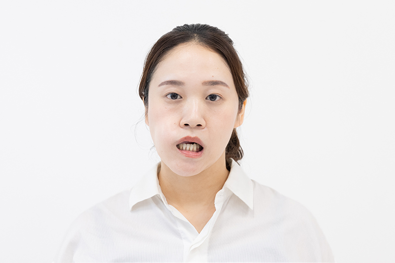 画像: 下の歯が見えるのは、下唇を下に引っ張っている証拠。口元の脂肪も下がってしまうので注意