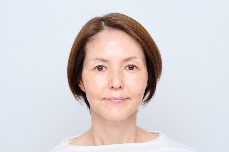 画像: after おでこや頬骨のあたりにツヤが生まれる