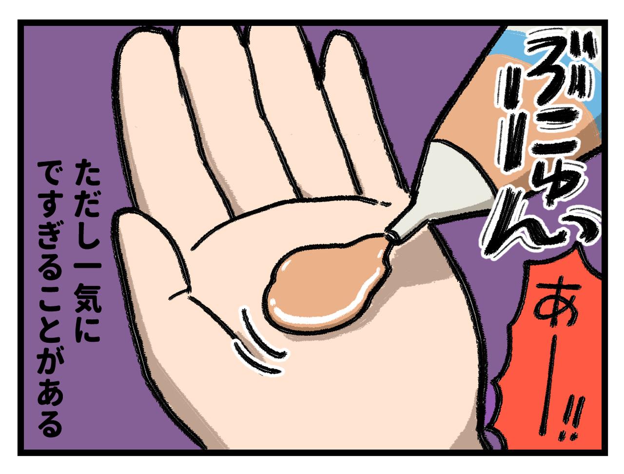 画像4: 便利だけど起きやすい事故