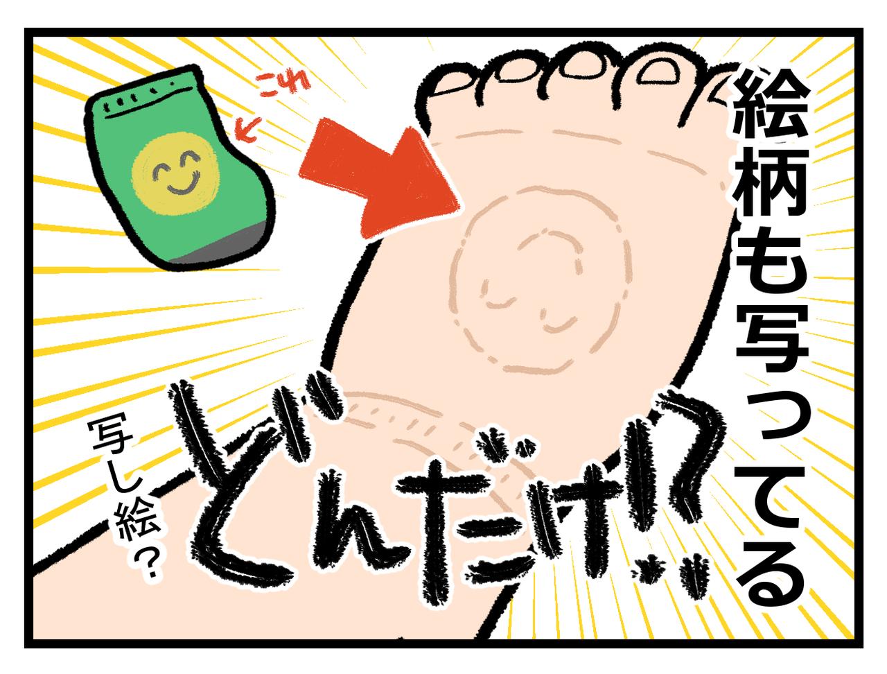 画像4: むくみ