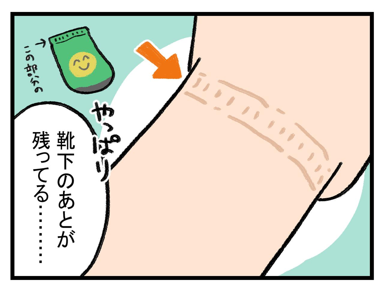 画像3: むくみ