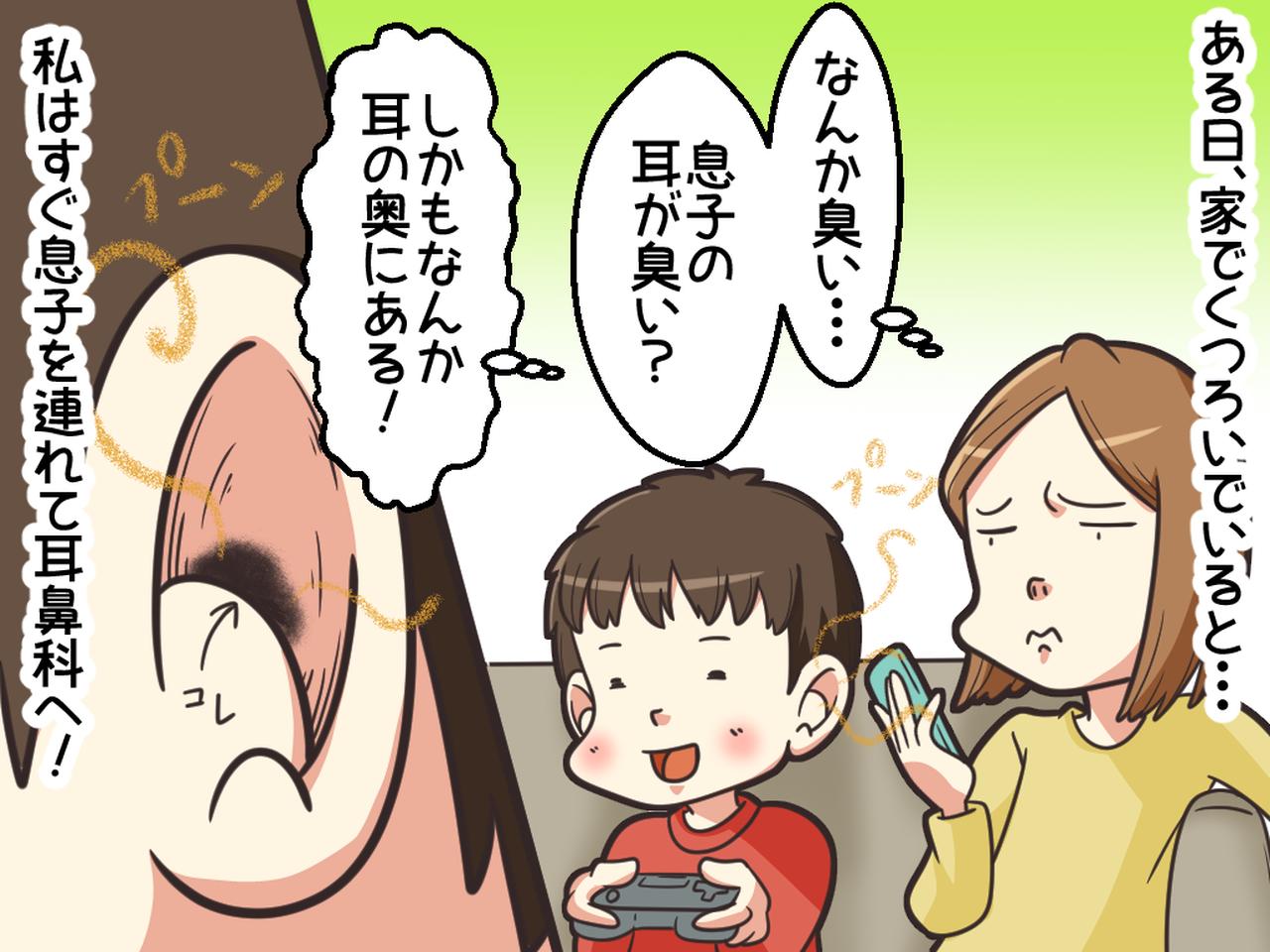 画像1: 子どもの耳から異臭が！！