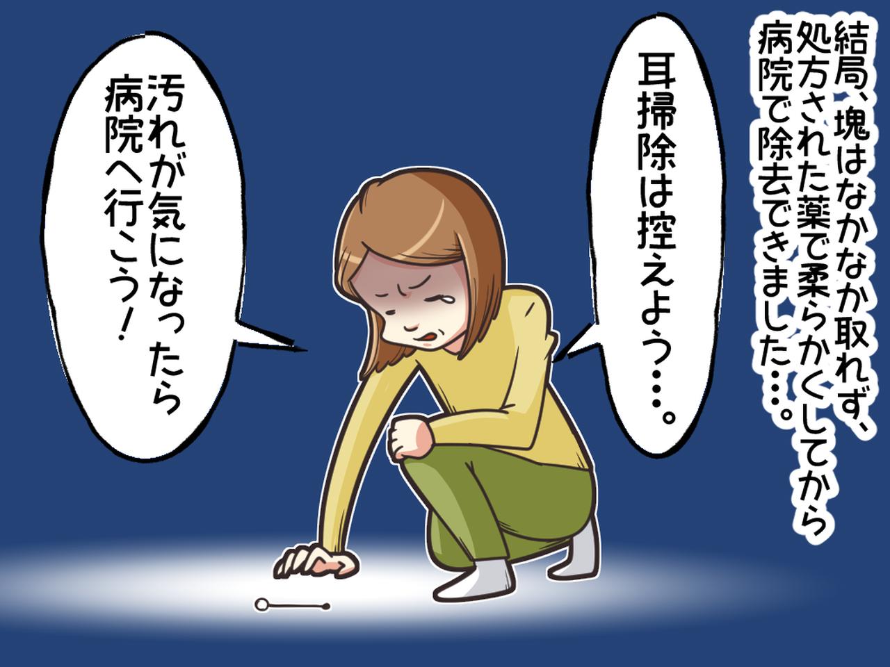 画像4: 子どもの耳から異臭が！！