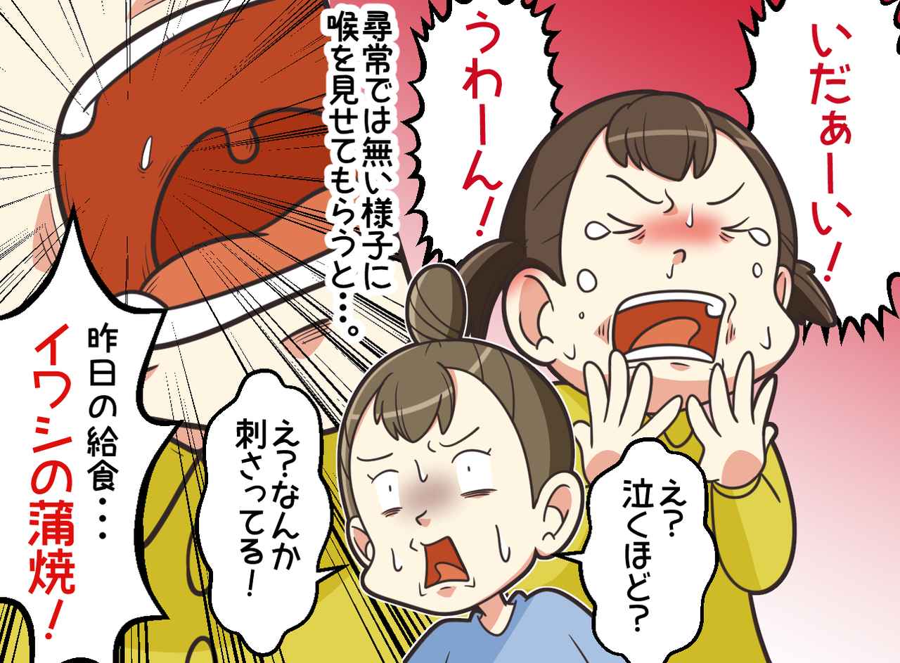 画像3: 喉の痛みの原因は？