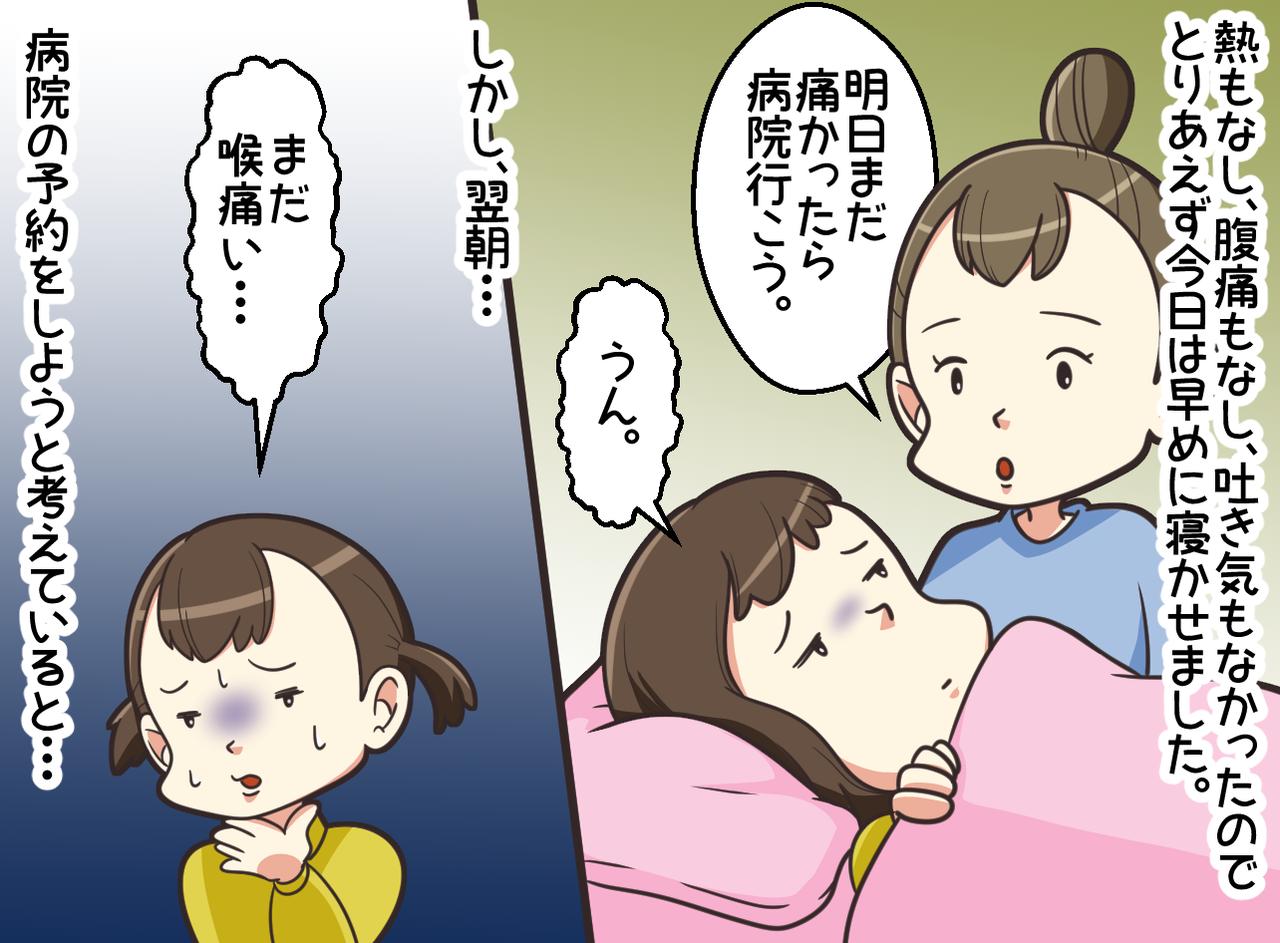 画像2: 喉の痛みの原因は？