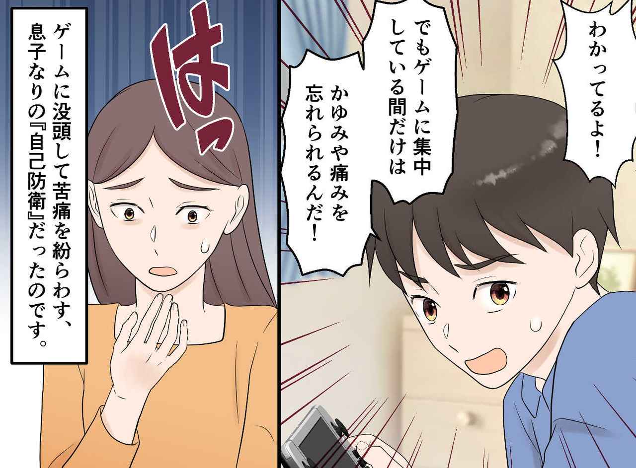 画像3: 帯状疱疹で学校を休んだ息子が選んだ、意外な対処法