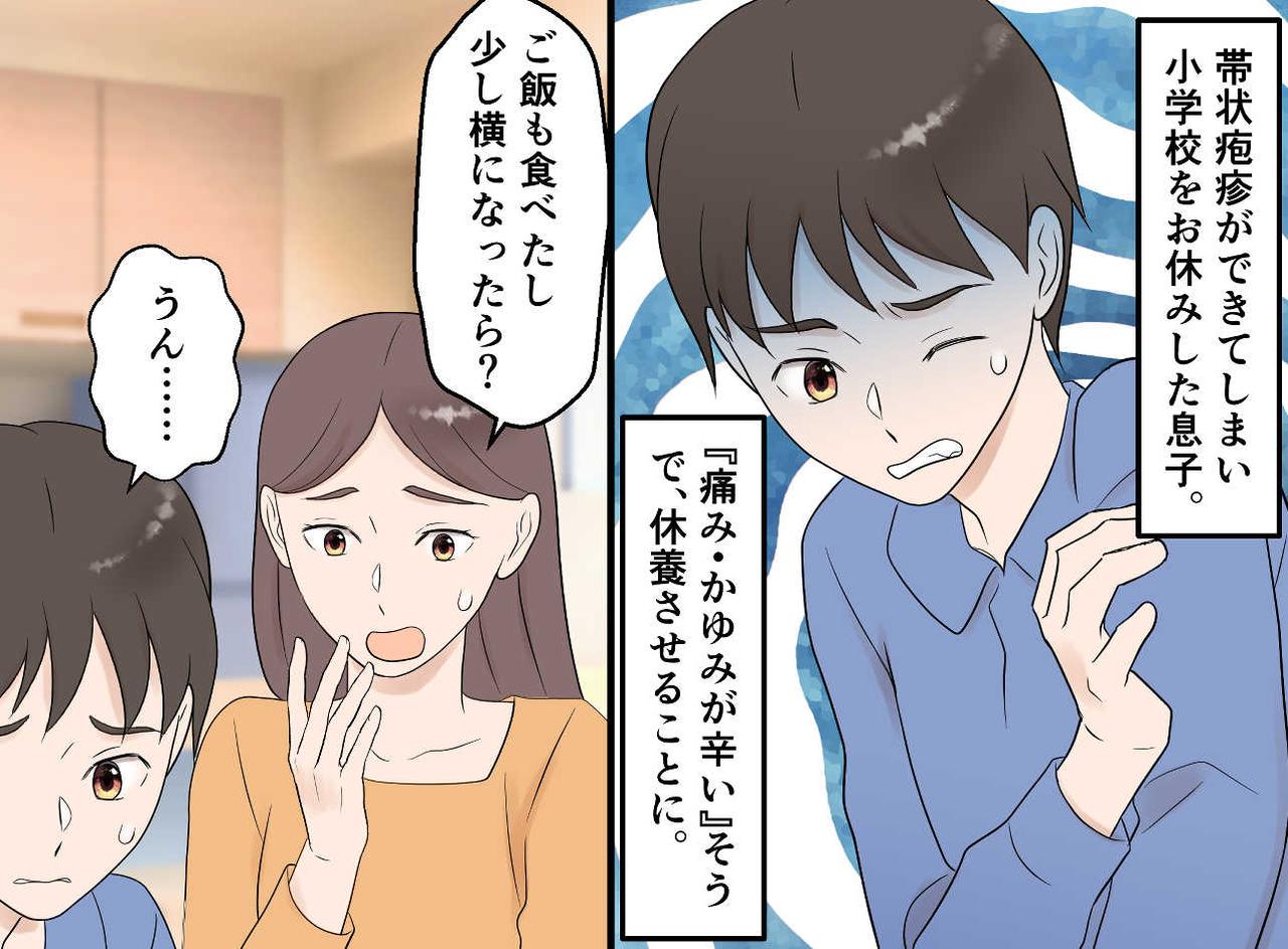 画像1: 帯状疱疹で学校を休んだ息子が選んだ、意外な対処法
