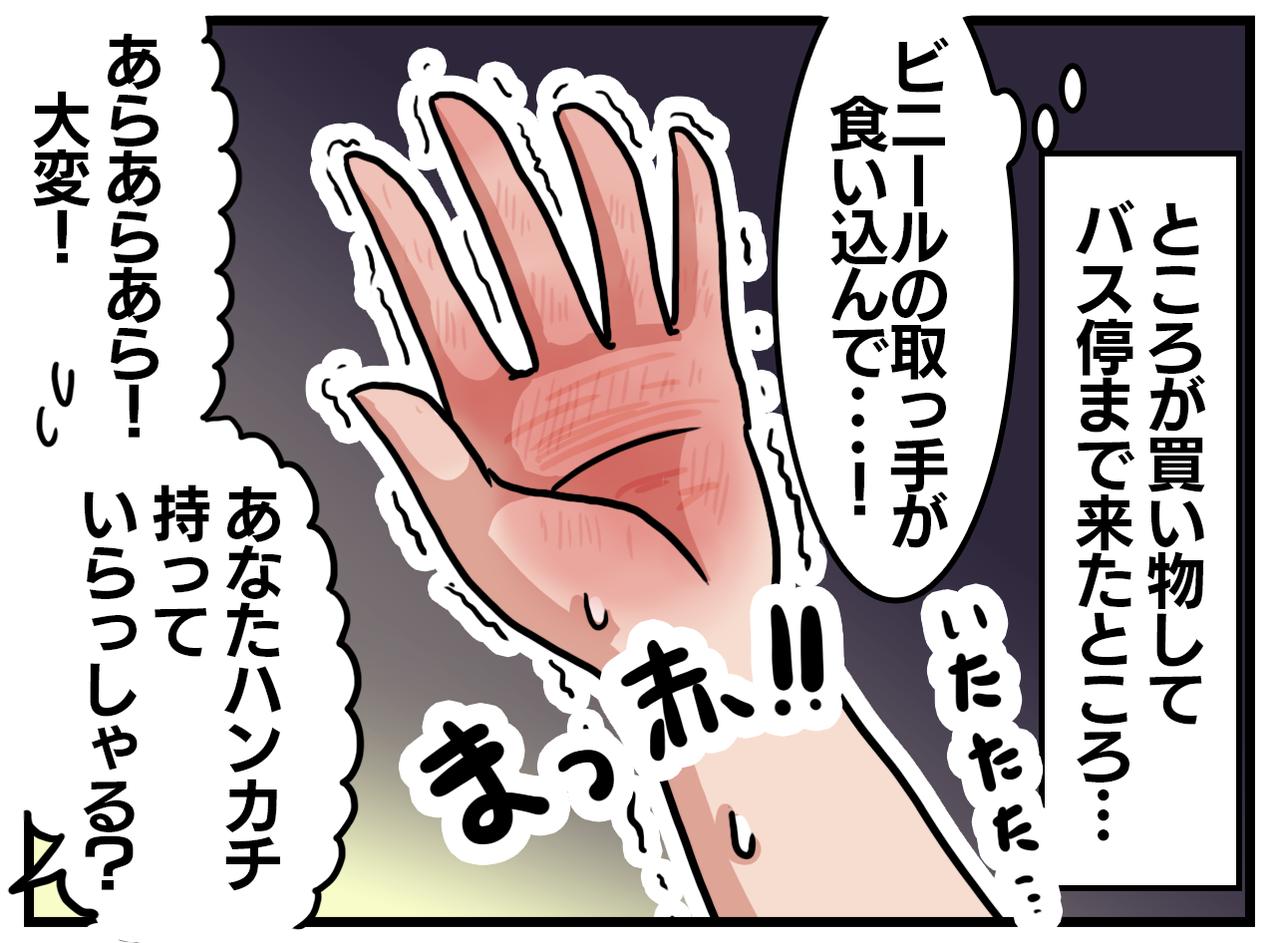 画像2: 油断してたら……