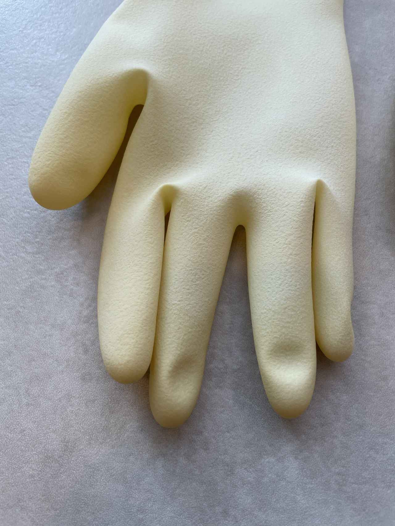 画像: 3か月使用したゴム手袋の指先