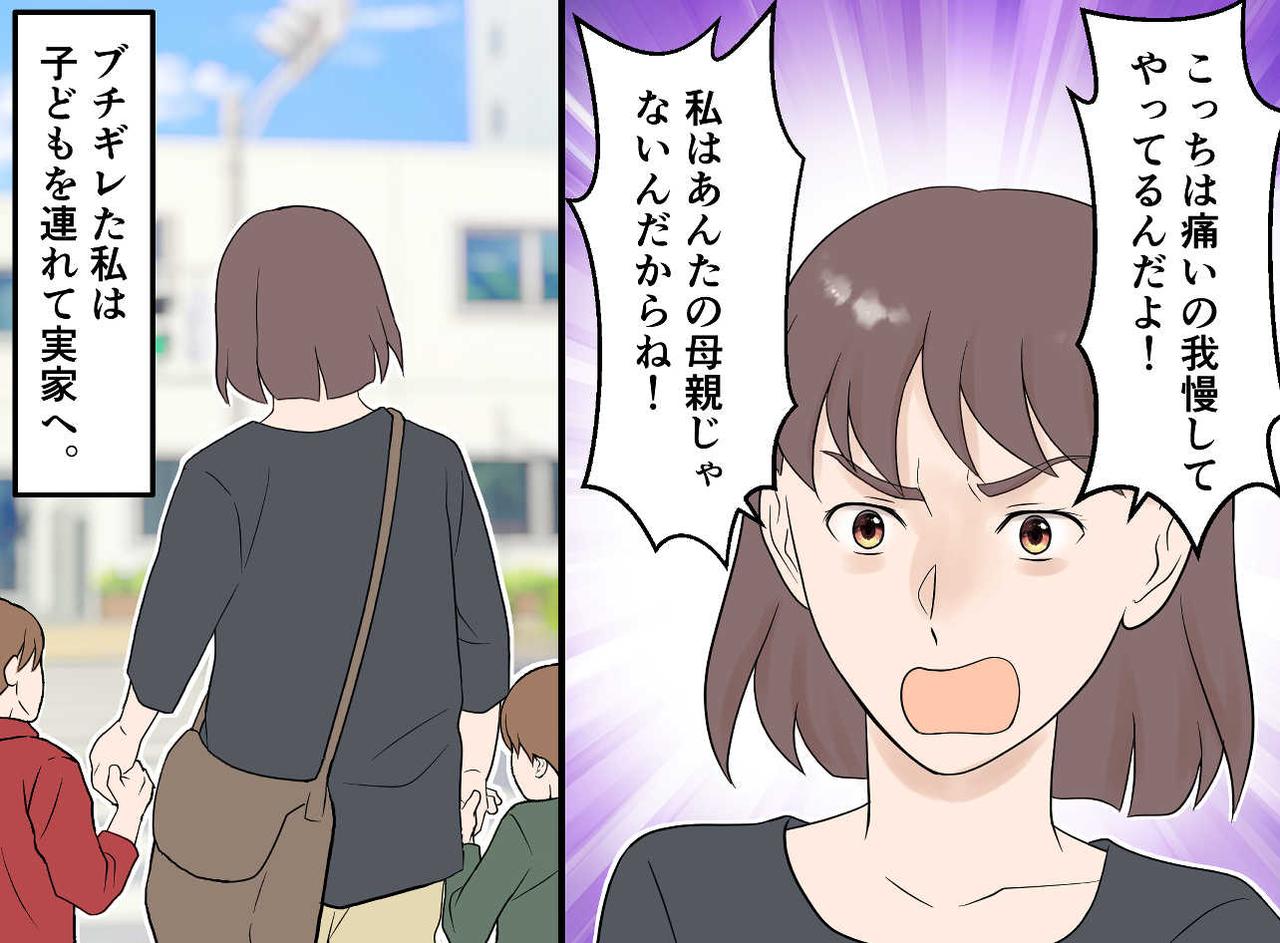 画像3: 【4コマ漫画】『ギプス姿の妻』に何言ってるの？！