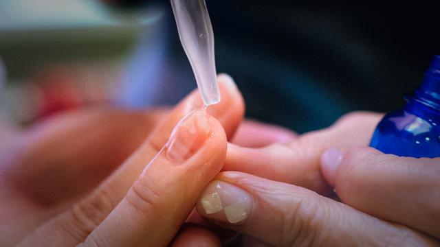 画像: 抗がん剤で爪も変形してしまう。指先のケアも大事なアピアランス支援だという