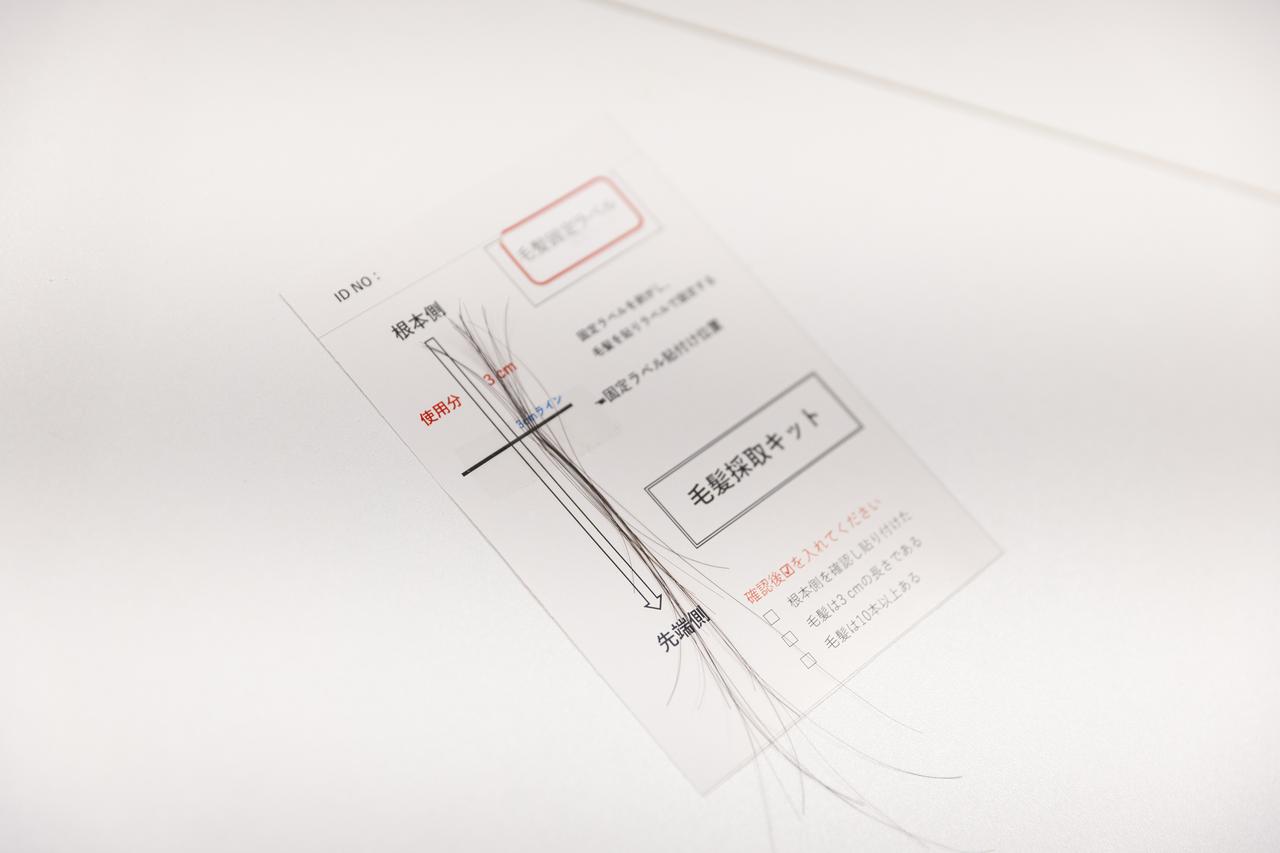 画像: 実際に採取された毛髪サンプル。一度の計測に10〜20本採取します