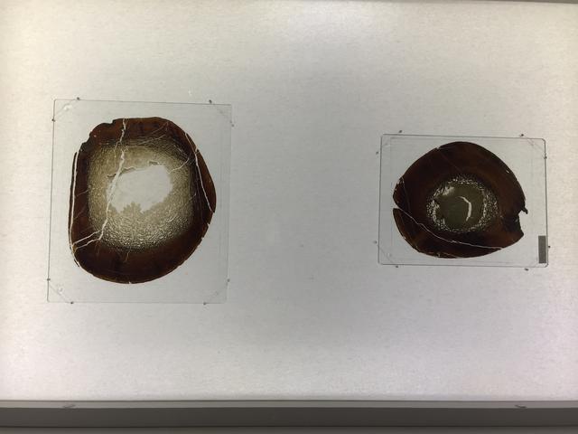画像: 大腿骨の薄片と脛骨の薄片