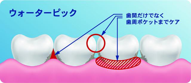 画像2: 世界シェアNo.1ブランド 次世代デンタルフロス『Waterpik』が日本上陸