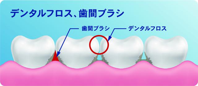 画像3: 世界シェアNo.1ブランド 次世代デンタルフロス『Waterpik』が日本上陸