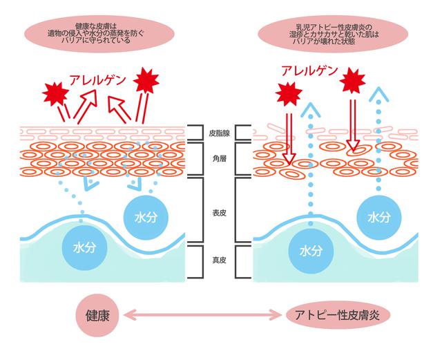 画像: 出典:海老澤 元宏(監)「食物アレルギーのすべてがわかる本」講談社, p72を参考に作成