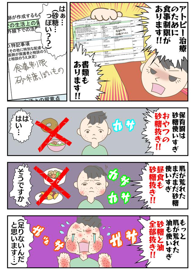 画像: アトピー治療のために食事制限!?